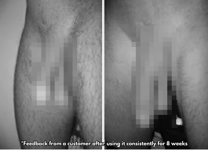 Before and after visual reference